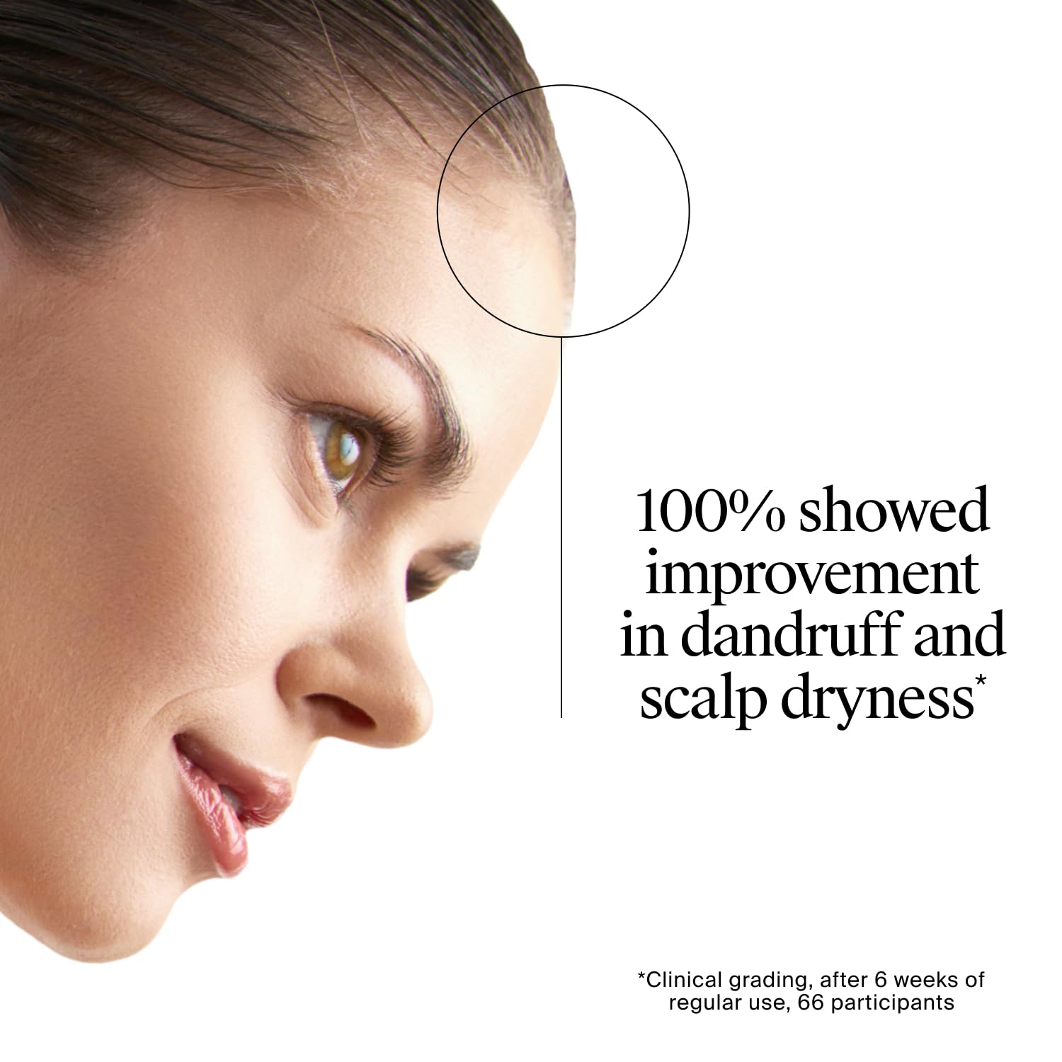 616w6EqckaL.jpg Neutrogena T/Gel Scalp Relief Anti-Dandruff Shampoo (250ml) With 3% Salicylic Acid, Suitable for Those Prone to Scalp Psoriasis and Seborrhoeic Dermatitis - Image 8